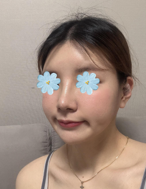 a113b9a07f1c93cea78a38bef61a319e_1647589565_3631.png a113b9a07f1c93cea78a38bef61a319e_1647589565_3631.png