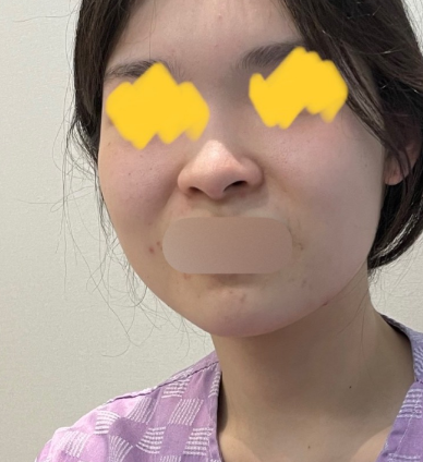 2f87d3203263104ce42076e92c8830bd_1659946843_9886.png