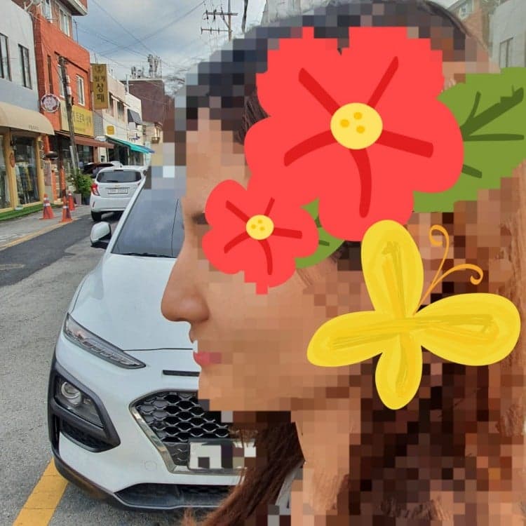 환자수술후기 — 왜 고민했나 싶어요!!